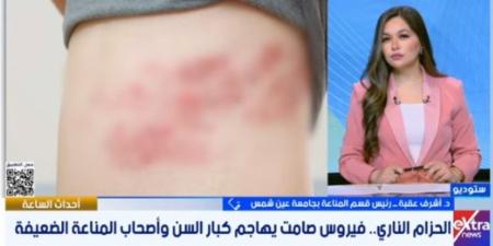 احذر الحزام الناري.. طبيب يوضح الأعراض والفئات الأكثر عرضة - وكالة البوصلة الإخبارية