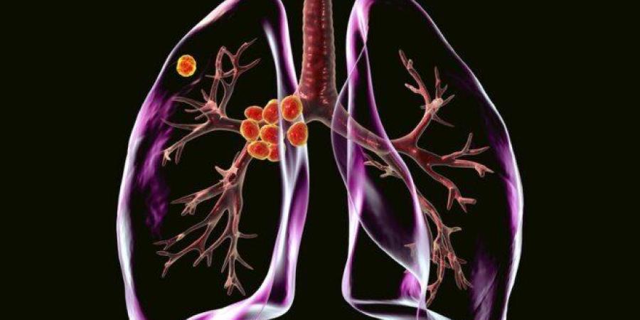 دراسة تكشف آلية جديدة وراء التليف الرئوي وتمهد لعلاجات مستقبلية - وكالة البوصلة الإخبارية