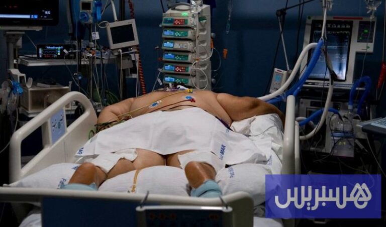 تحذيرات من أطباء أمريكيين بشأن عوامل خطر الإصابة بالفتق